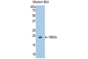 Western Blotting (WB) image for anti-Protein Kinase N2 (PKN2) (AA 323-464) antibody (ABIN1860246) (PKN2 anticorps  (AA 323-464))