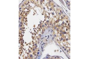 staining BPC3 in human testis tissue sections by Immunohistochemistry (IHC-P - raformaldehyde-fixed, raffin-embedded sections). (PABPC3 anticorps  (AA 84-117))
