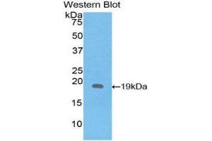 Western Blotting (WB) image for anti-Interleukin 1 Receptor Antagonist (IL1RN) (AA 26-177) antibody (ABIN1859394) (IL1RN anticorps  (AA 26-177))