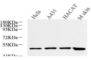 Western Blot analysis of various samples using CK-17 Polyclonal Antibody at dilution of 1:600. (KRT17 anticorps)