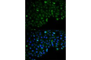 Immunofluorescence analysis of U2OS cells using HK2 antibody. (Hexokinase 2 anticorps)