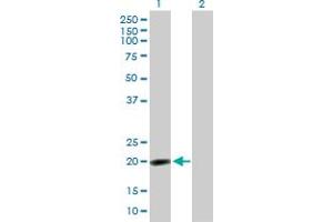 Western Blot analysis of NPM3 expression in transfected 293T cell line by NPM3 MaxPab polyclonal antibody. (NPM3 anticorps  (AA 1-178))