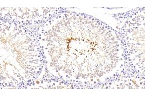 Detection of RLN in Rat Testis Tissue using Polyclonal Antibody to Relaxin (RLN) (Relaxin anticorps  (AA 23-186))