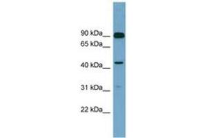 Image no. 1 for anti-Diacylglycerol Kinase, alpha 80kDa (DGKA) (AA 107-156) antibody (ABIN6743747) (DGKA anticorps  (AA 107-156))