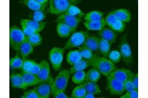 IF analysis of GFPT1 using anti-GFPT1 antibody (ABIN7602887). (GFPT1 anticorps  (C-Term))