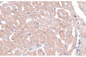 Immunohistochemistry of paraffin-embedded Mouse heart using COL11A1 Polyclonal Antibody at dilution of 1:100 (40x lens). (COL11A1 anticorps)