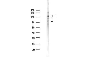 anti-Disabled Homolog 1 (Drosophila) (DAB1) (pTyr232) antibody