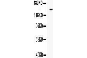Western Blotting (WB) image for anti-Fms-Related tyrosine Kinase 1 (VEGFR1) (FLT1) (AA 278-298), (N-Term) antibody (ABIN3042978) (FLT1 anticorps  (N-Term))