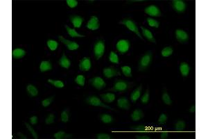 Immunofluorescence of monoclonal antibody to RAD51C on HeLa cell.