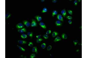 Immunofluorescence staining of Hela cells with ABIN7173590 at 1:100, counter-stained with DAPI. (FAM115C anticorps  (AA 472-590))