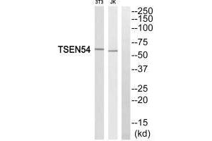 Western blot analysis of extracts from 3T3 cells and Jurkat cells, using TSEN54 antibody. (TSEN54 anticorps)