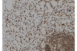 ABIN6272612 at 1/100 staining Human gastric tissue by IHC-P. (DYRK2 anticorps  (Internal Region))