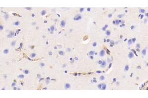 Detection of HB in Human Cerebrum Tissue using Polyclonal Antibody to Hemoglobin (HB) (Hemoglobin anticorps)