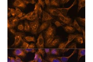 Immunofluorescence analysis of U-2 OS cells using SEPT5 Polyclonal Antibody at dilution of 1:100.