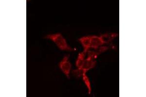 ABIN6278547 staining 293 cells by IF/ICC. (ACTN1/2/3/4 anticorps)