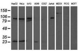 Image no. 2 for anti-Anaphase Promoting Complex Subunit 2 (ANAPC2) antibody (ABIN1496638) (ANAPC2 anticorps)