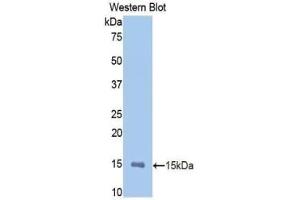 Detection of Recombinant MMP12, Rat using Polyclonal Antibody to Matrix Metalloproteinase 12 (MMP12)