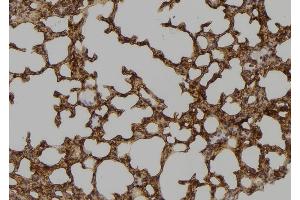 ABIN6265825 and ABIN6276650 at 1/100 staining Mouse lung tissue by IHC-P.