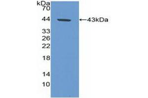Detection of Recombinant CA9, Human using Polyclonal Antibody to Carbonic Anhydrase IX (CA9)