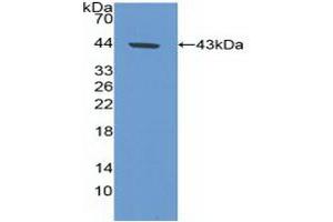 Detection of Recombinant CA9, Human using Polyclonal Antibody to Carbonic Anhydrase IX (CA9) (CA9 anticorps  (AA 59-414))