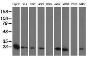 Image no. 2 for anti-Superoxide Dismutase 2, Mitochondrial (SOD2) antibody (ABIN1499530) (SOD2 anticorps)