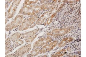 Immunoperoxidase of purified MaxPab antibody to MPPED1 on formalin-fixed paraffin-embedded human stomach.