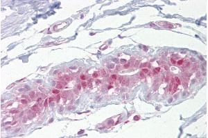Immunohistochemistry with Breast tissue at an antibody concentration of 5µg/ml using anti-Ehf antibody (ARP36843_P050) (EHF anticorps  (Middle Region))