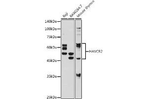 Western blot analysis of extracts of various cell lines, using TIM-3/H antibody (ABIN7267618) at 1:1000 dilution. (TIM3 anticorps)