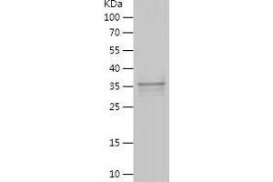 Western Blotting (WB) image for Scm-Like with Four Mbt Domains 2 (SFMBT2) (AA 2-93) protein (His-IF2DI Tag) (ABIN7124989) (SFMBT2 Protein (AA 2-93) (His-IF2DI Tag))