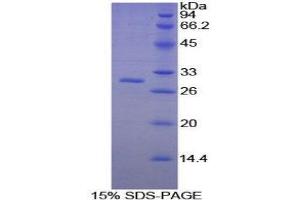 SDS-PAGE (SDS) image for Platelet-Activating Factor Acetylhydrolase 1b, Catalytic Subunit 3 (29kDa) (PAFAH1B3) (AA 1-232) protein (His tag) (ABIN2126335)
