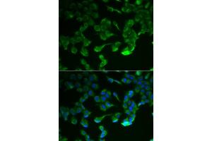 anti-Complement Component 1, R Subcomponent (C1R) (AA 466-705) antibody
