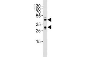 Western blot analysis of lysate from mouse heart tissue lysate using SIRT3 antibody diluted at 1:1000.