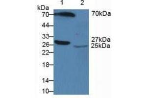 Figure. (APCS anticorps  (AA 23-223))