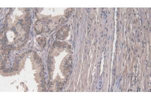 Detection of COL1a2 in Human Prostate Tissue using Polyclonal Antibody to Collagen Type I Alpha 2 (COL1a2)