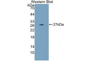 Detection of Recombinant LAMa5, Mouse using Polyclonal Antibody to Laminin Alpha 5 (LAMa5) (Laminin alpha 5 anticorps  (AA 3517-3718))