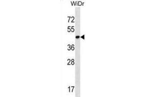 Western Blotting (WB) image for anti-THAP Domain Containing 11 (THAP11) antibody (ABIN2998587) (THAP11 anticorps)