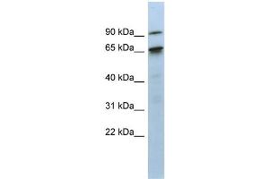 WB Suggested Anti-KIAA0427 Antibody Titration:  0.