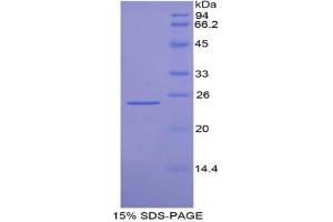 SDS-PAGE analysis of Mouse FDFT1 Protein. (FDFT1 Protéine)