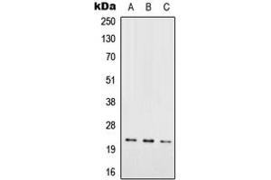 Western blot analysis of RAB7L1 expression in HEK293T (A), SP2/0 (B), PC12 (C) whole cell lysates. (RAB7L1 anticorps  (Center))