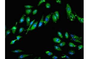 Immunofluorescent analysis of Hela cells using ABIN7161958 at dilution of 1:100 and Alexa Fluor 488-congugated AffiniPure Goat Anti-Rabbit IgG(H+L)