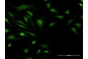 Immunofluorescence of monoclonal antibody to ZNF274 on HeLa cell.
