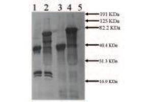 Rabbit anti Mouse tPA (2ug/ml) Secondary:  anti Rabbit IgG ABC Kit Lane 1:  0. (PLAT anticorps)