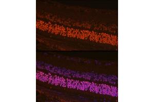 Immunofluorescence analysis of mouse retina cells using CRX Rabbit pAb (ABIN6130142, ABIN6139059, ABIN6139060 and ABIN6221382) at dilution of 1:200 (40x lens). (CRX anticorps  (AA 120-285))