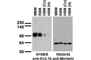 Immunoblots on brain membranes prepared from whole rat (RBM) and mouse (MBM) brain, and from human cerebral cortex [HBM(Cx)] and hippocampus [HBM(H)].