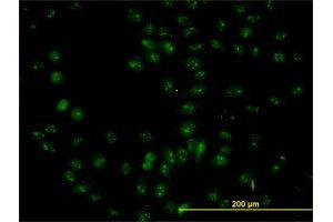 Immunofluorescence of purified MaxPab antibody to NOP56 on HeLa cell. (NOP56 anticorps  (AA 49-174))
