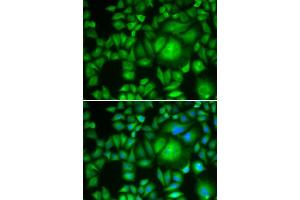 Immunofluorescence analysis of A-549 cells using CBR1 antibody.
