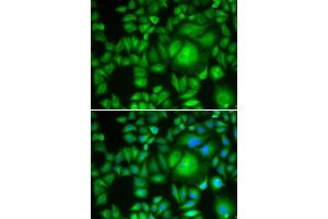 Immunofluorescence analysis of A-549 cells using CBR1 antibody. (CBR1 anticorps  (AA 1-277))