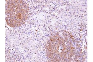IHC-P Image Immunohistochemical analysis of paraffin-embedded SAS xenograft, using KHS, antibody at 1:100 dilution.
