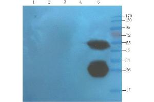 Western Blot using anti-TNF alpha antibody  Mouse liver (lane 1), mouse spinal cord (lane 2), mouse testis (lane 3), mouse colon (lane 4) and human thyroid tumour (lane 5) samples were resolved on a 10% SDS PAGE gel and blots probed with  at 1. (Recombinant TNF alpha (Infliximab Biosimilar) anticorps)