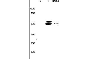 Lane 1: mouse brain lysates Lane 2: mouse intestine lysates probed with Anti BECN1/Beclin 1/ATG6 Polyclonal Antibody, Unconjugated (ABIN675384) at 1:200 in 4C. (Beclin 1 anticorps  (AA 201-330))